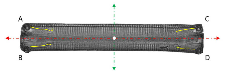 Raphes and axes of Eunotia in girdle view