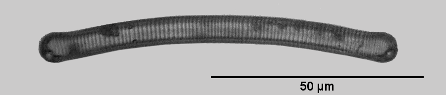 Valve view of Eunotia sp.